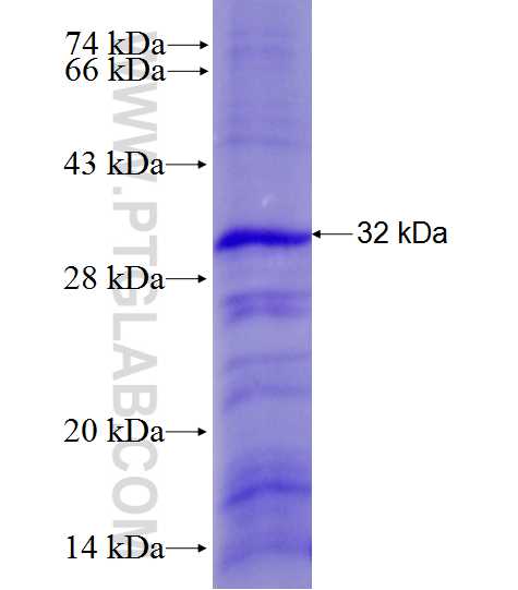 CSF2RB fusion protein Ag28170 SDS-PAGE CSF2RB fusion protein Ag28170 SDS-PAGE