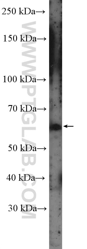 Western Blot (WB) analysis of MCF-7 cells using CSGALNACT1 Polyclonal antibody (26913-1-AP)