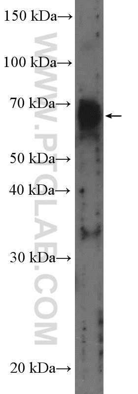 Western Blot (WB) analysis of PC-3 cells using CSGALNACT1 Polyclonal antibody (26913-1-AP)