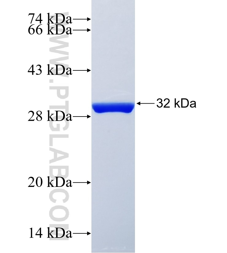 CSGALNACT1 fusion protein Ag25455 SDS-PAGE