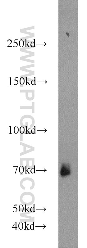 Western Blot (WB) analysis of K-562 cells using CSGALNACT2 Polyclonal antibody (17420-1-AP)