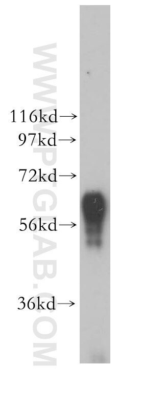 Western Blot (WB) analysis of RAW264.7 using CSGALNACT2 Polyclonal antibody (17420-1-AP)