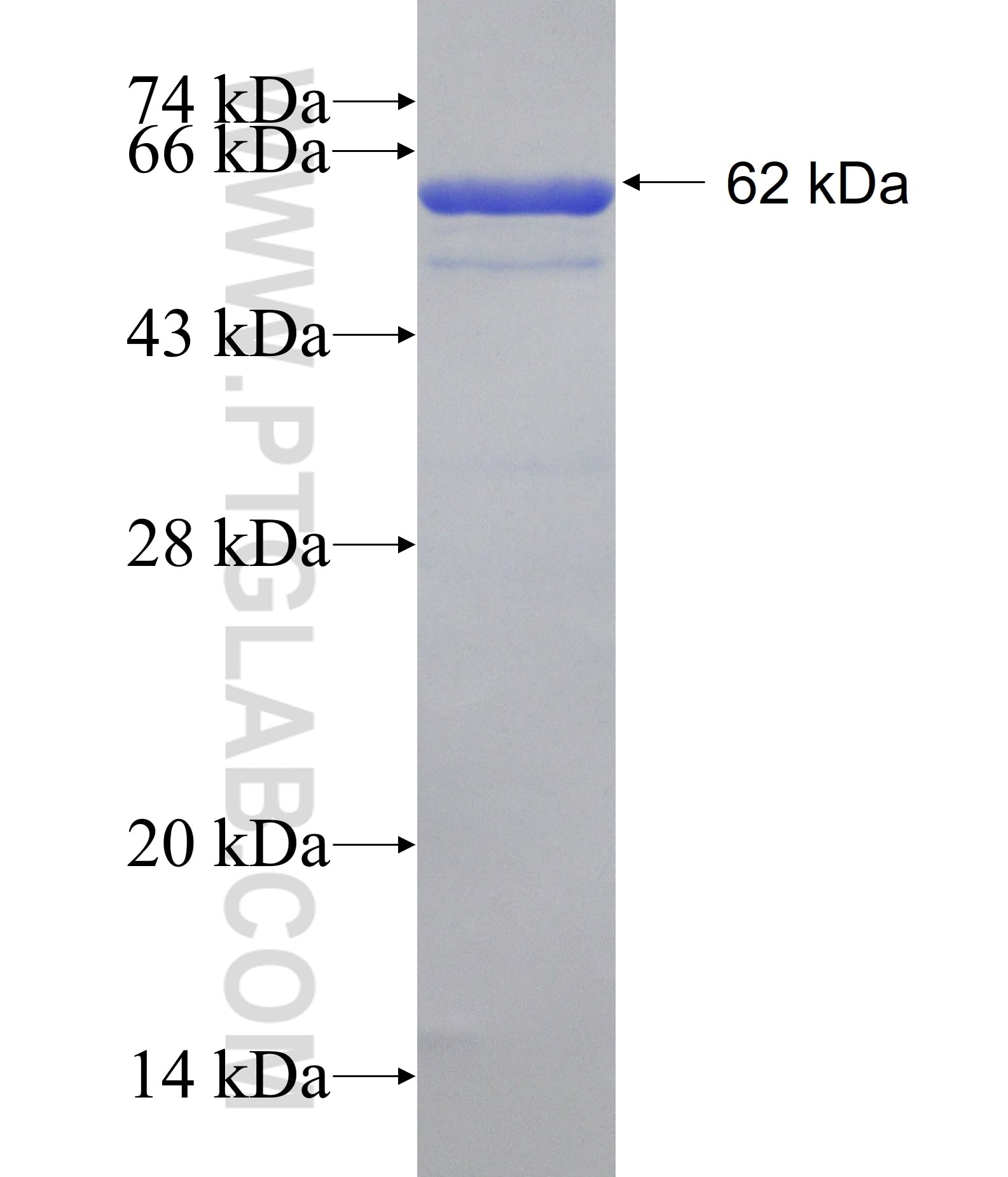 CSGALNACT2 fusion protein Ag31332 SDS-PAGE