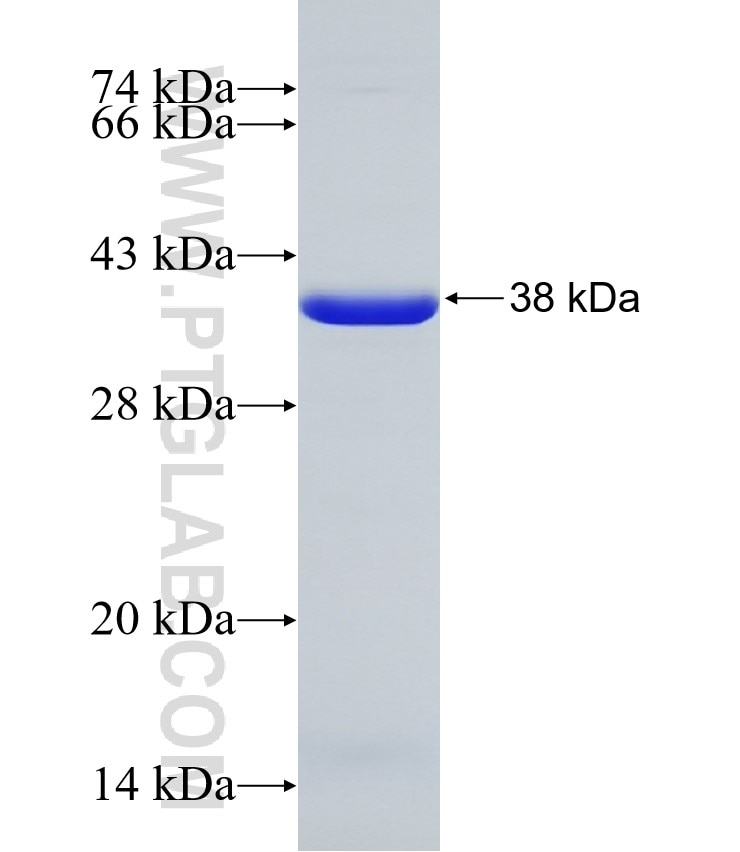 CSGALNACT2 fusion protein Ag31355 SDS-PAGE CSGALNACT2 fusion protein Ag31355 SDS-PAGE