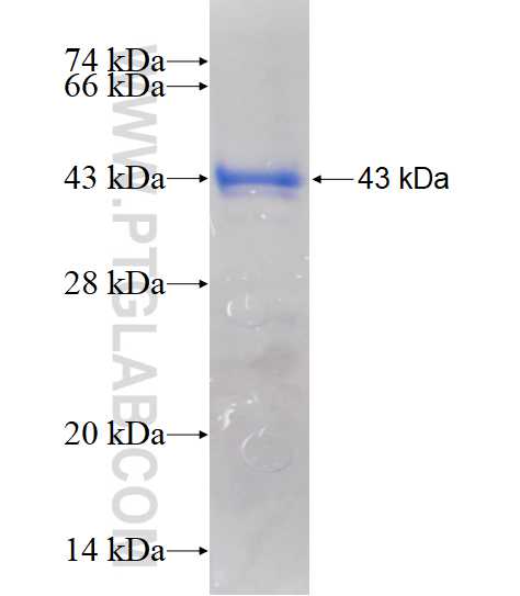 CSGALNACT2 fusion protein Ag11415 SDS-PAGE