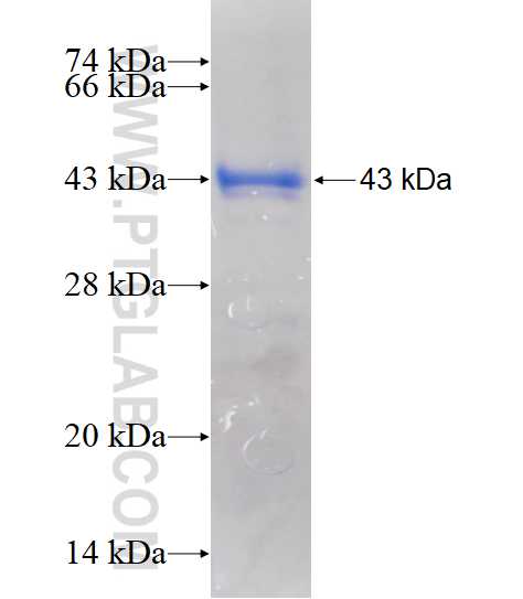 CSGALNACT2 fusion protein Ag11415 SDS-PAGE