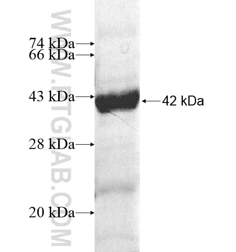 CSGLCA-T fusion protein Ag10485 SDS-PAGE
