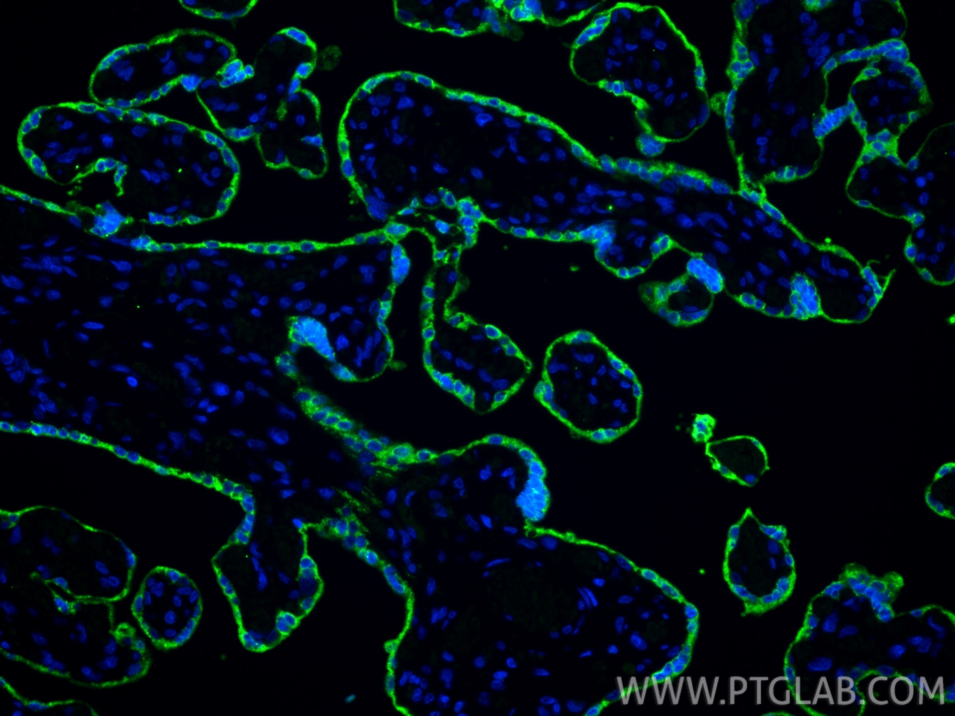 IF Staining of human placenta using 10178-1-AP Immunofluorescence (IF) / fluorescent staining of human placenta tissue using Placental lactogen Polyclonal antibody (10178-1-AP)