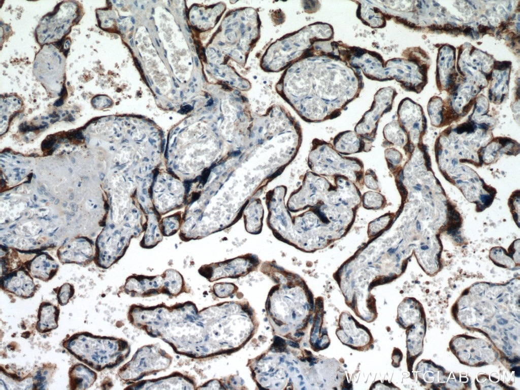 Immunohistochemistry (IHC) staining of human placenta tissue using Placental lactogen Polyclonal antibody (10178-1-AP)