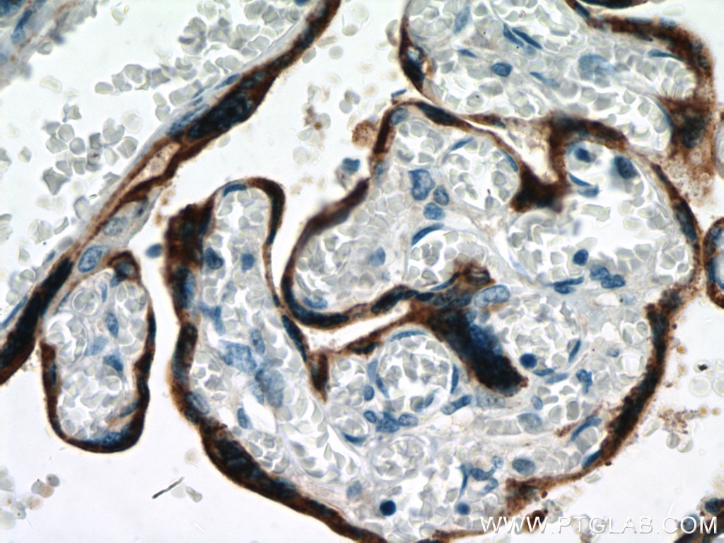IHC staining of human placenta using 10178-1-AP