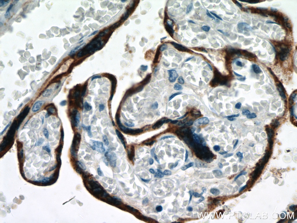 Immunohistochemistry (IHC) staining of human placenta tissue using Placental lactogen Polyclonal antibody (10178-1-AP)