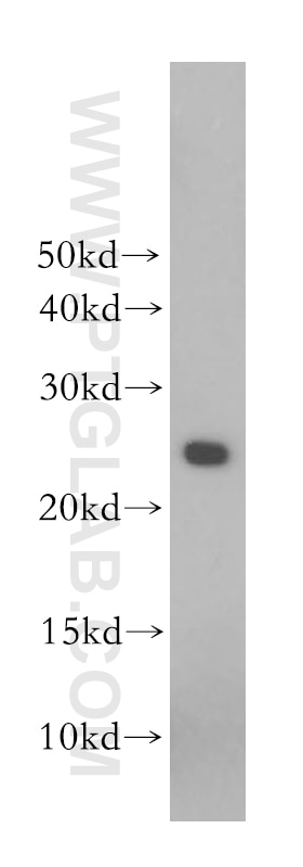 Western Blot (WB) analysis of human placenta tissue using Placental lactogen Polyclonal antibody (10178-1-AP)