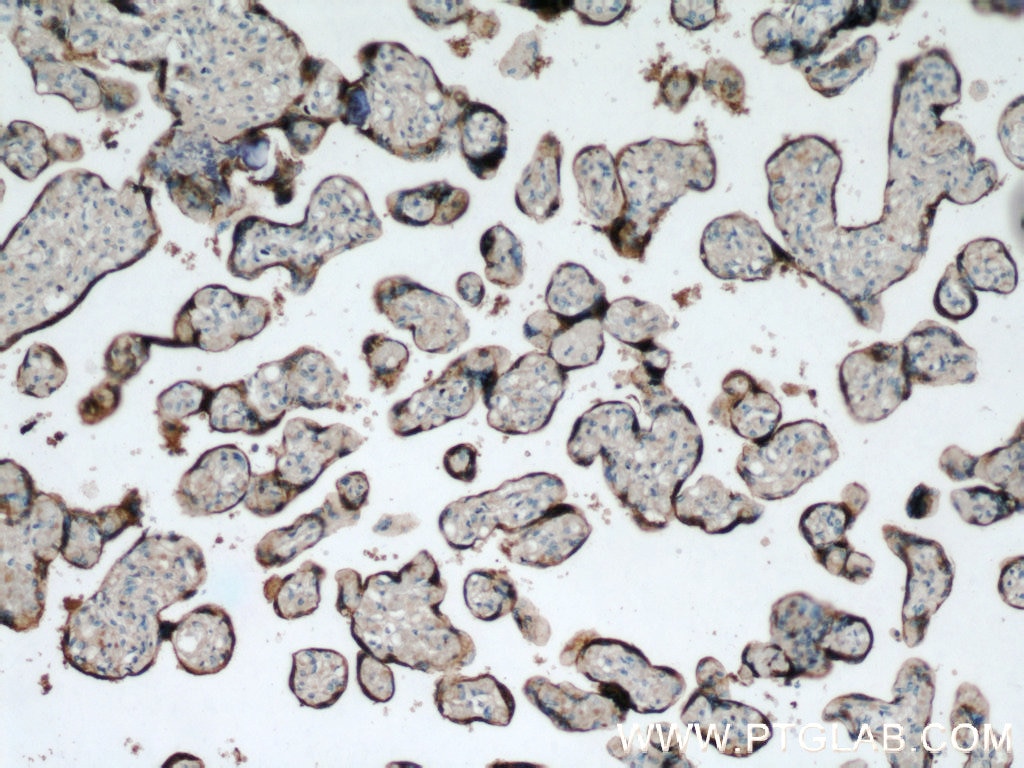 Immunohistochemistry (IHC) staining of human placenta tissue using Placental lactogen Polyclonal antibody (55236-1-AP)