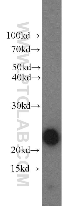 Western Blot (WB) analysis of human placenta tissue using Placental lactogen Polyclonal antibody (55236-1-AP)