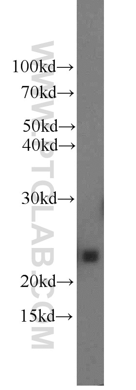 Western Blot (WB) analysis of human placenta tissue using Placental lactogen Polyclonal antibody (55236-1-AP)