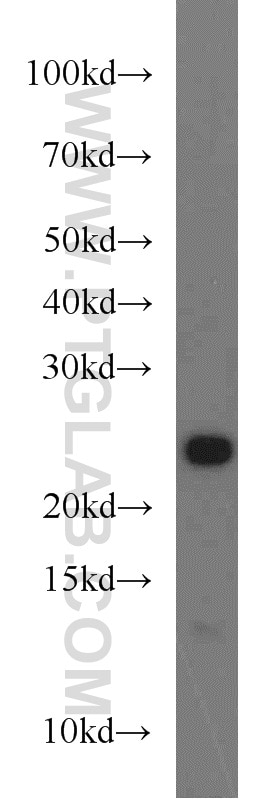 Western Blot (WB) analysis of human placenta tissue using Placental lactogen Polyclonal antibody (55236-1-AP)