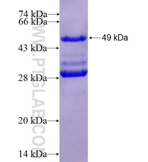 CSH1 fusion protein Ag0201 SDS-PAGE