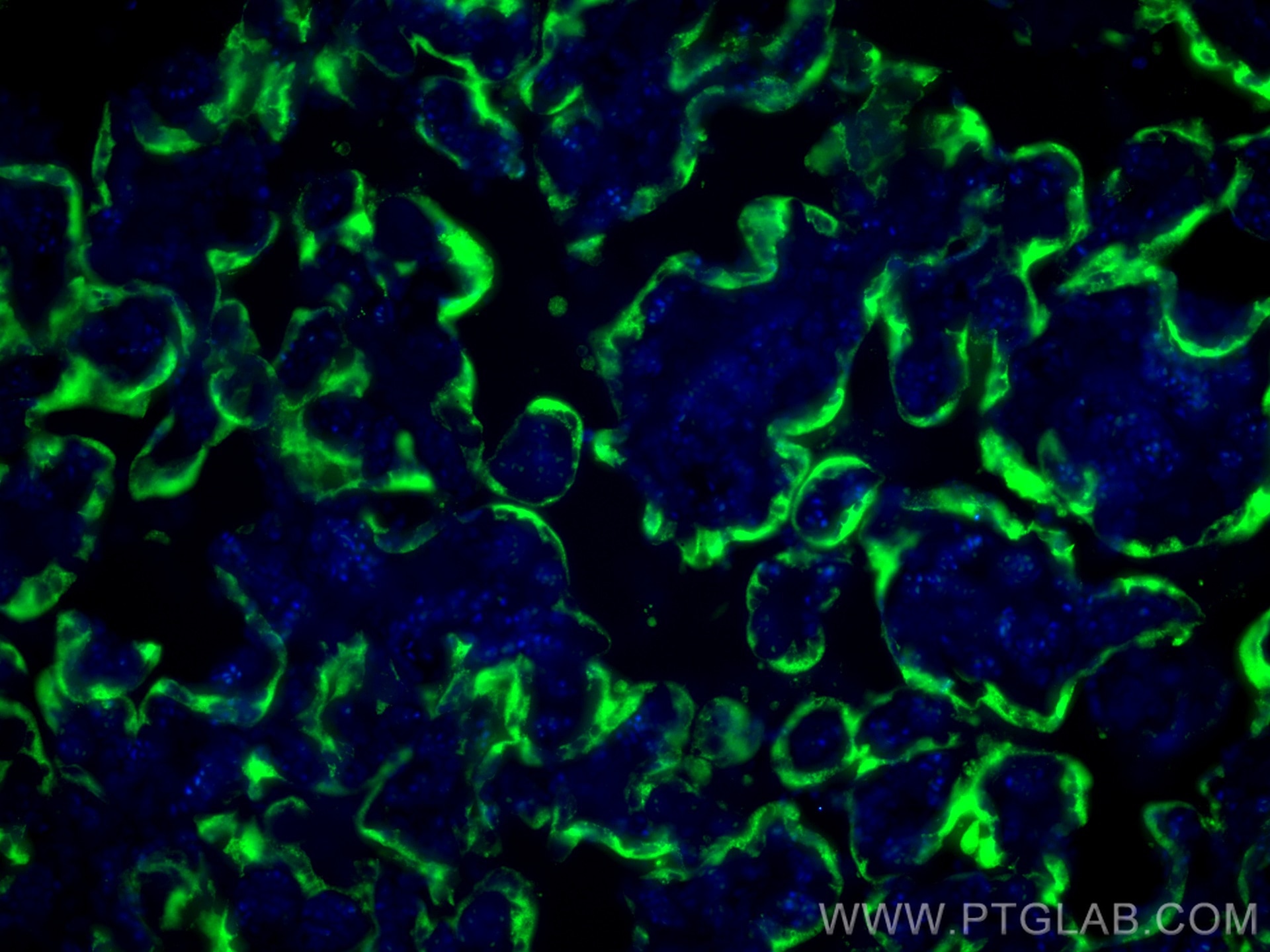 Immunofluorescence (IF) / fluorescent staining of human placenta tissue using Placental lactogen Polyclonal antibody (16326-1-AP)