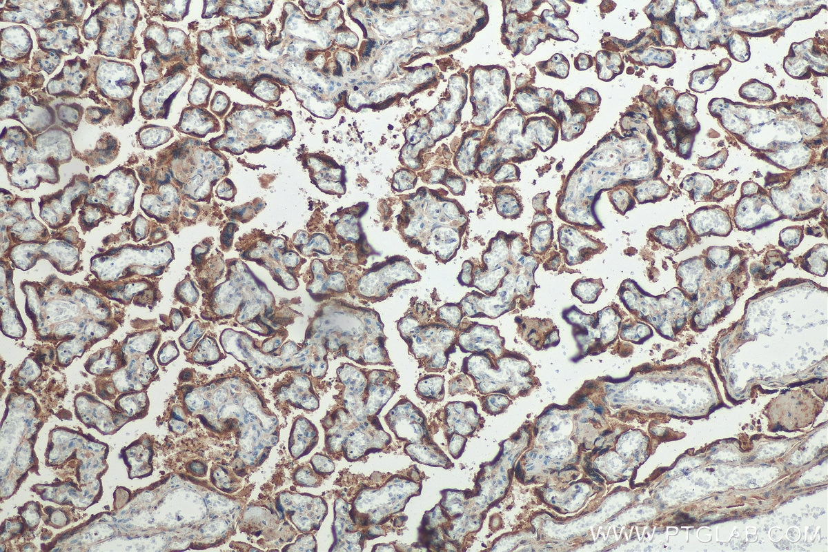 Immunohistochemistry (IHC) staining of human placenta tissue using Placental lactogen Polyclonal antibody (16326-1-AP)