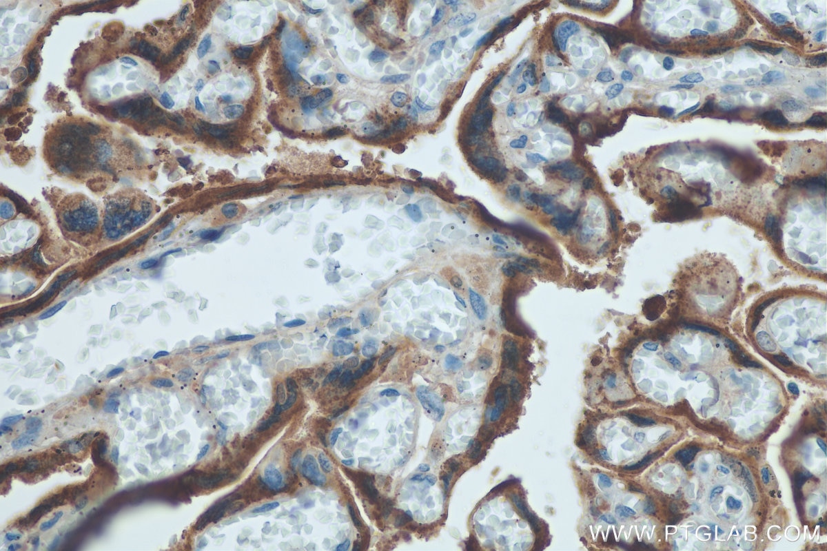 IHC staining of human placenta using 16326-1-AP