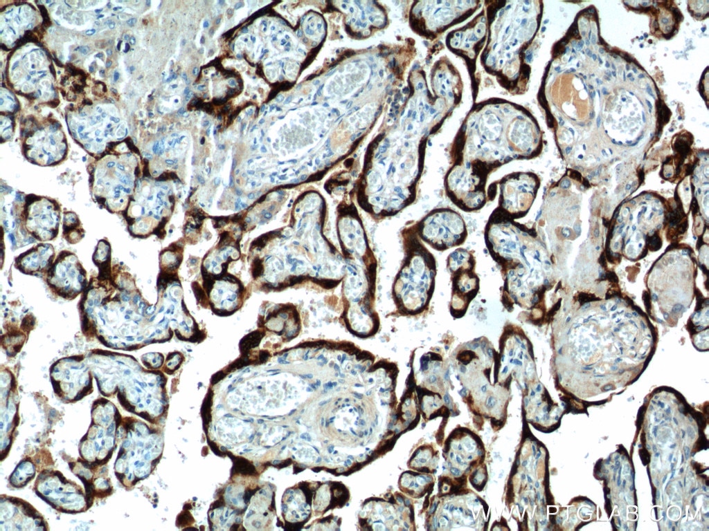 Immunohistochemistry (IHC) staining of human placenta tissue using Placental lactogen Polyclonal antibody (16326-1-AP)