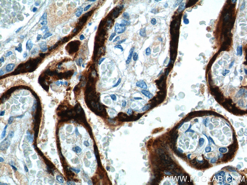 Immunohistochemistry (IHC) staining of human placenta tissue using Placental lactogen Polyclonal antibody (16326-1-AP)