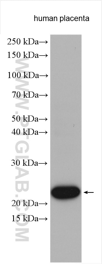 Western Blot (WB) analysis of various lysates using Placental lactogen Polyclonal antibody (16326-1-AP)