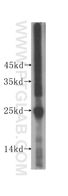 Western Blot (WB) analysis of human placenta tissue using Placental lactogen Polyclonal antibody (16326-1-AP)