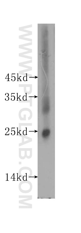 Western Blot (WB) analysis of human colon tissue using Placental lactogen Polyclonal antibody (16326-1-AP)