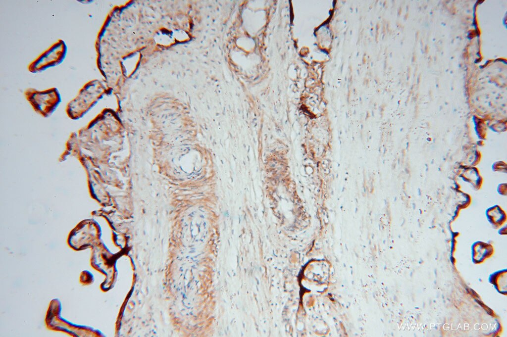 Immunohistochemistry (IHC) staining of human placenta tissue using CSHL1 Polyclonal antibody (11883-1-AP)