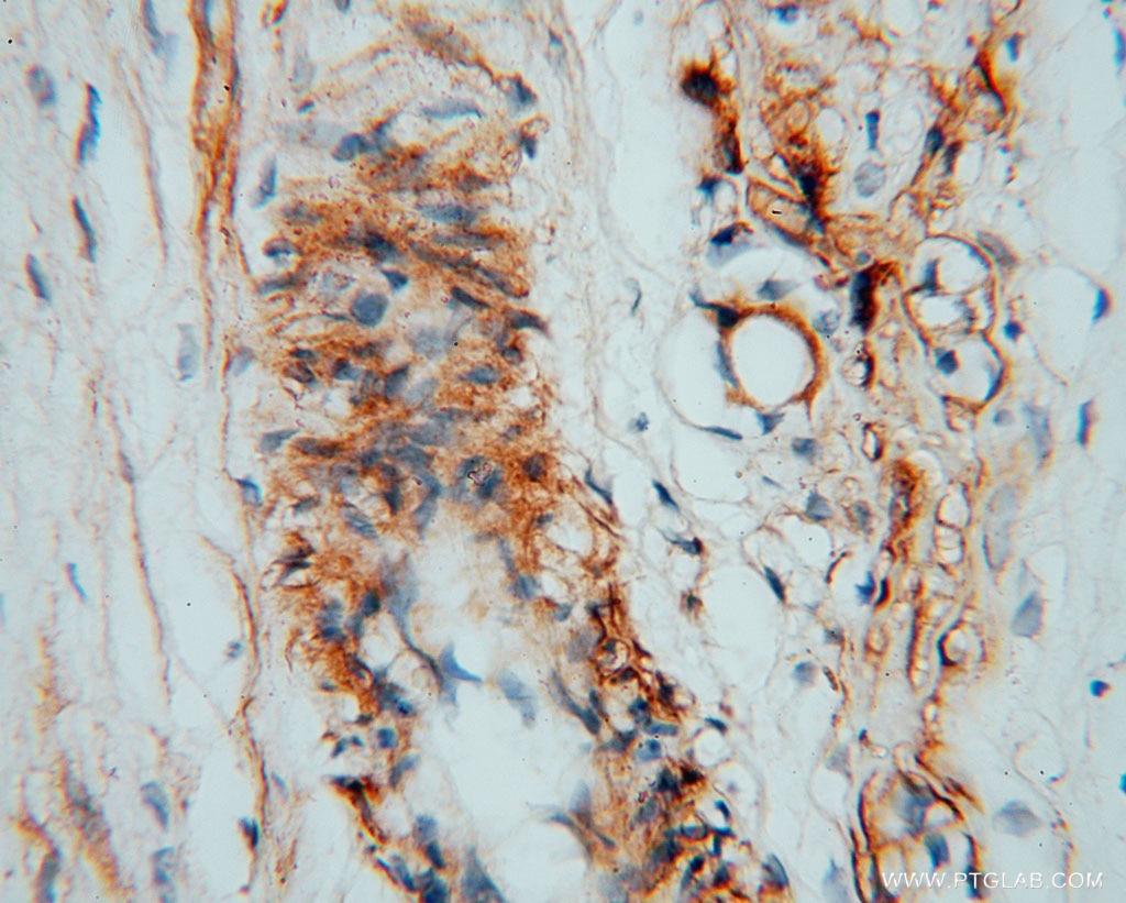 Immunohistochemistry (IHC) staining of human placenta tissue using CSHL1 Polyclonal antibody (11883-1-AP)