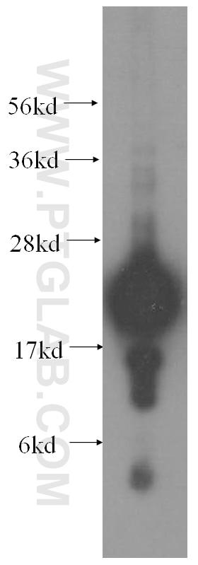 CSHL1