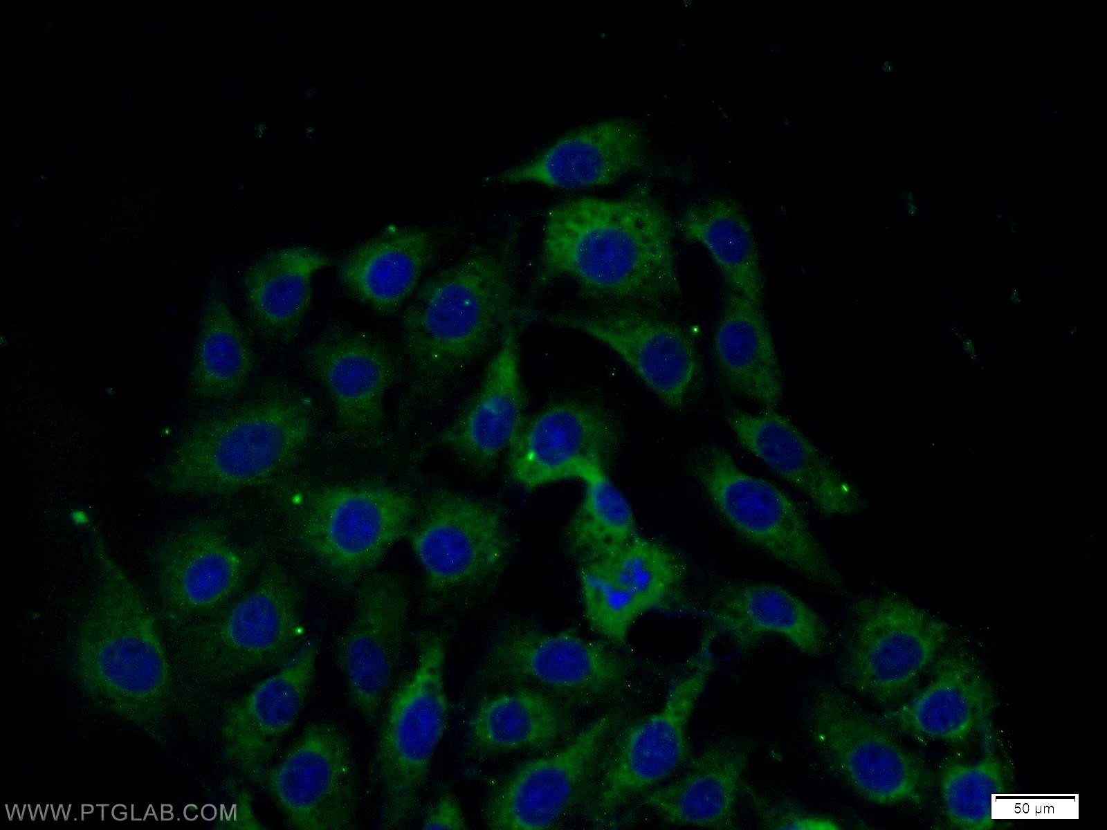 Immunofluorescence (IF) / fluorescent staining of SH-SY5Y cells using CSK Polyclonal antibody (17720-1-AP)