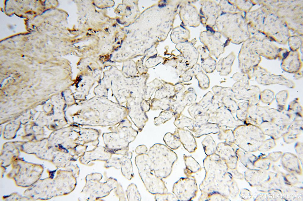 IHC staining of human placenta using 17720-1-AP