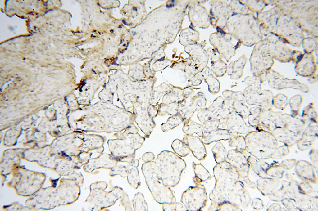 Immunohistochemistry (IHC) staining of human placenta tissue using CSK Polyclonal antibody (17720-1-AP)