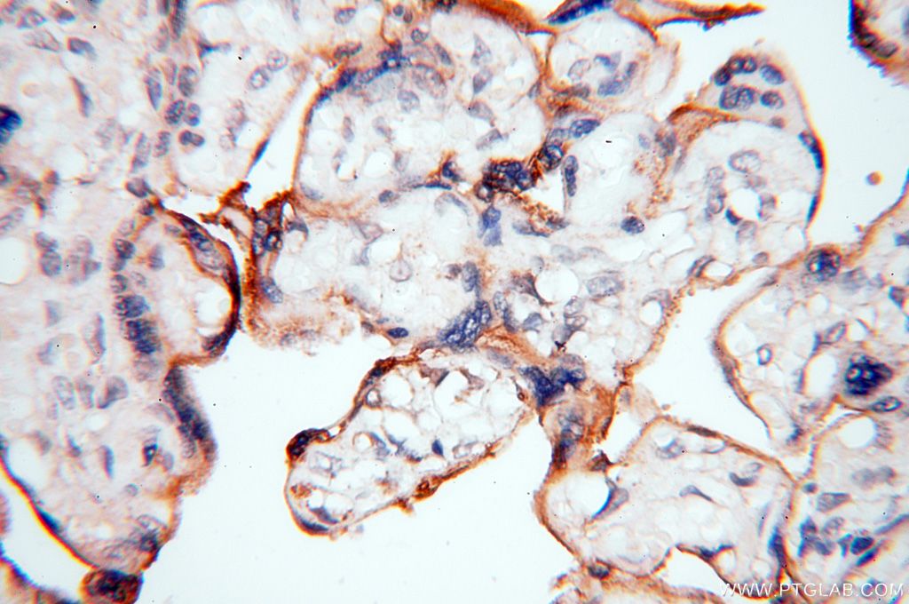 Immunohistochemistry (IHC) staining of human placenta tissue using CSK Polyclonal antibody (17720-1-AP)