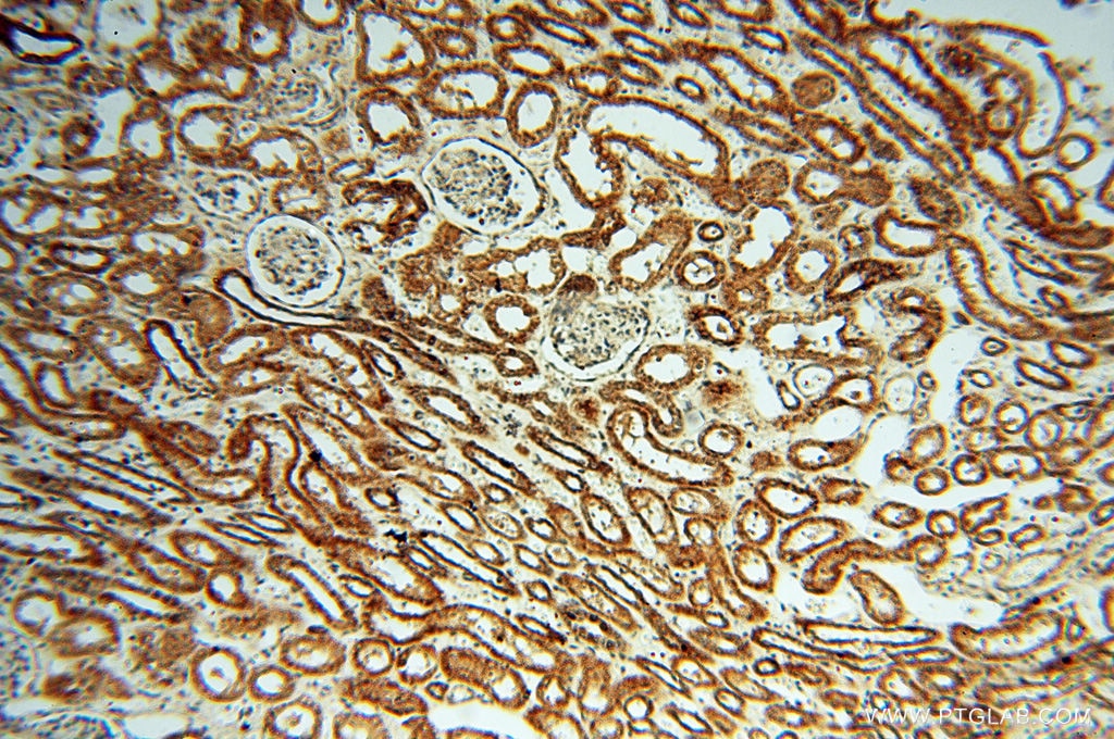 Immunohistochemistry (IHC) staining of human kidney tissue using CSK Polyclonal antibody (17720-1-AP)