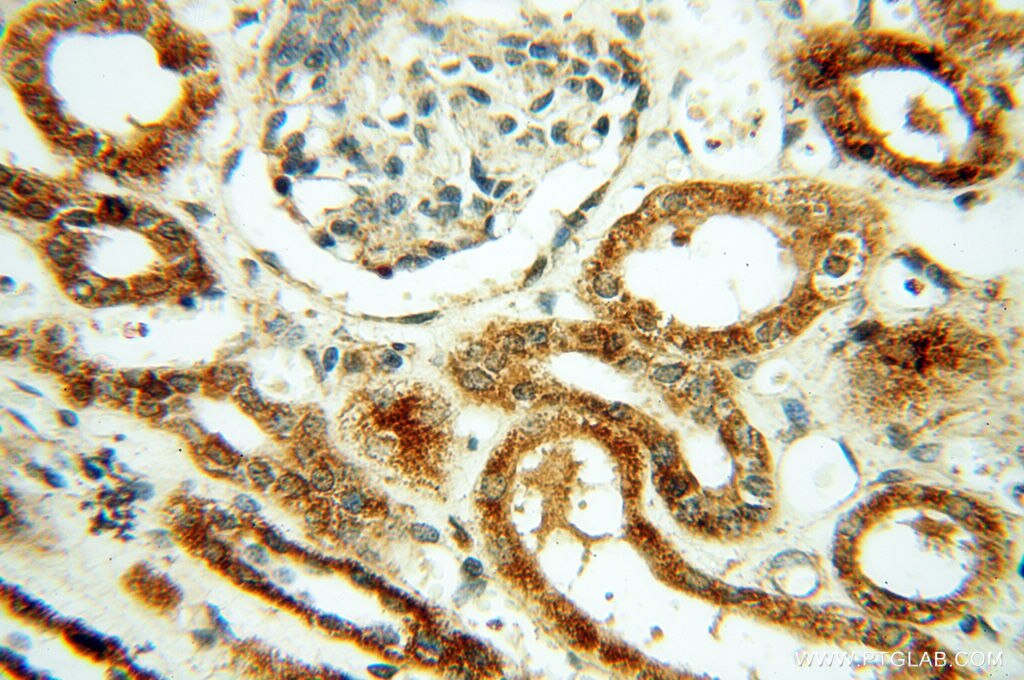 Immunohistochemistry (IHC) staining of human kidney tissue using CSK Polyclonal antibody (17720-1-AP)