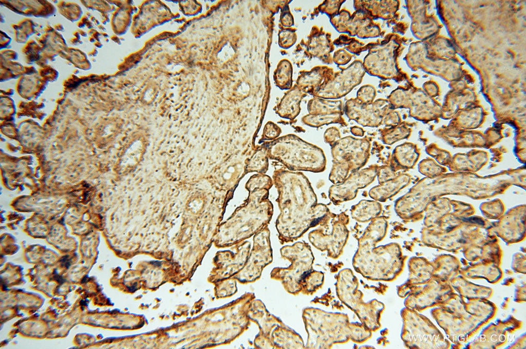 Immunohistochemistry (IHC) staining of human placenta tissue using CSK Polyclonal antibody (17720-1-AP)