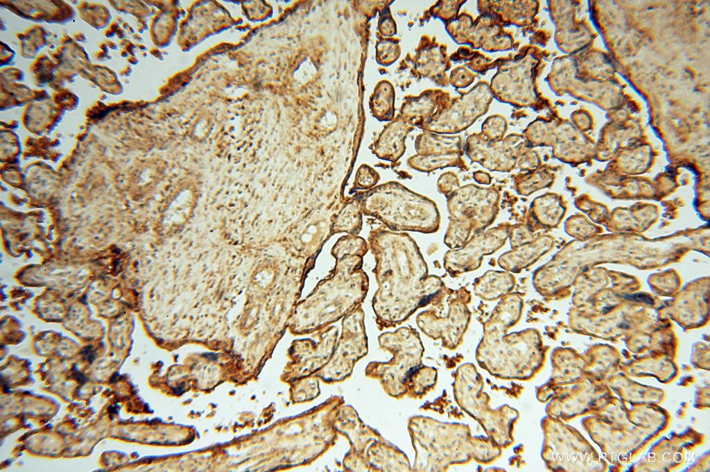 IHC staining of human placenta using 17720-1-AP