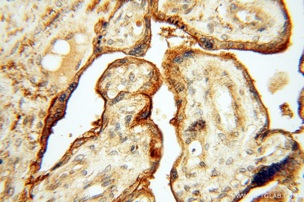 Immunohistochemistry (IHC) staining of human placenta tissue using CSK Polyclonal antibody (17720-1-AP)