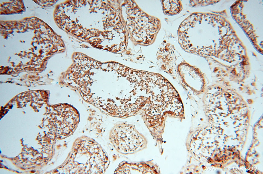 Immunohistochemistry (IHC) staining of human testis tissue using CSK Polyclonal antibody (17720-1-AP)