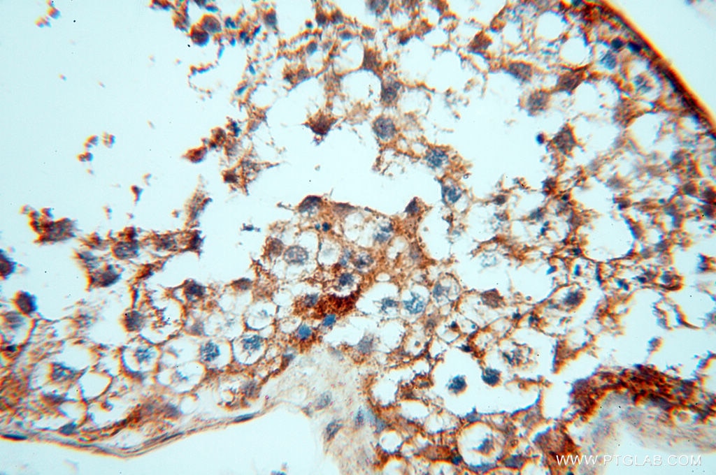 Immunohistochemistry (IHC) staining of human testis tissue using CSK Polyclonal antibody (17720-1-AP)