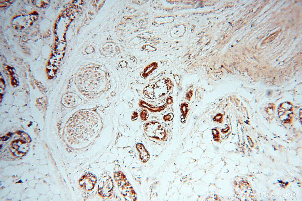 Immunohistochemistry (IHC) staining of human skin tissue using CSK Polyclonal antibody (17720-1-AP)