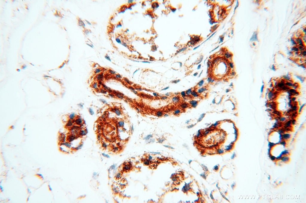 IHC staining of human skin using 17720-1-AP