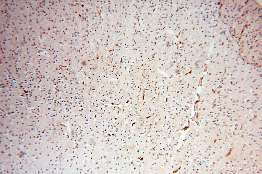 IHC staining of human brain using 17720-1-AP