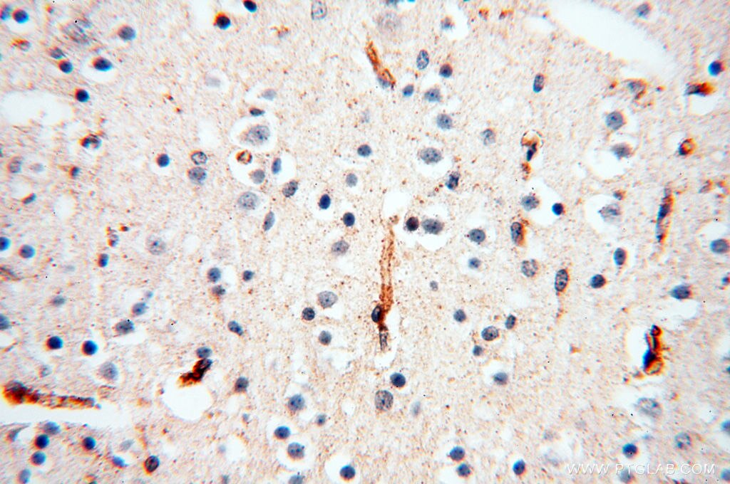 Immunohistochemistry (IHC) staining of human brain tissue using CSK Polyclonal antibody (17720-1-AP)