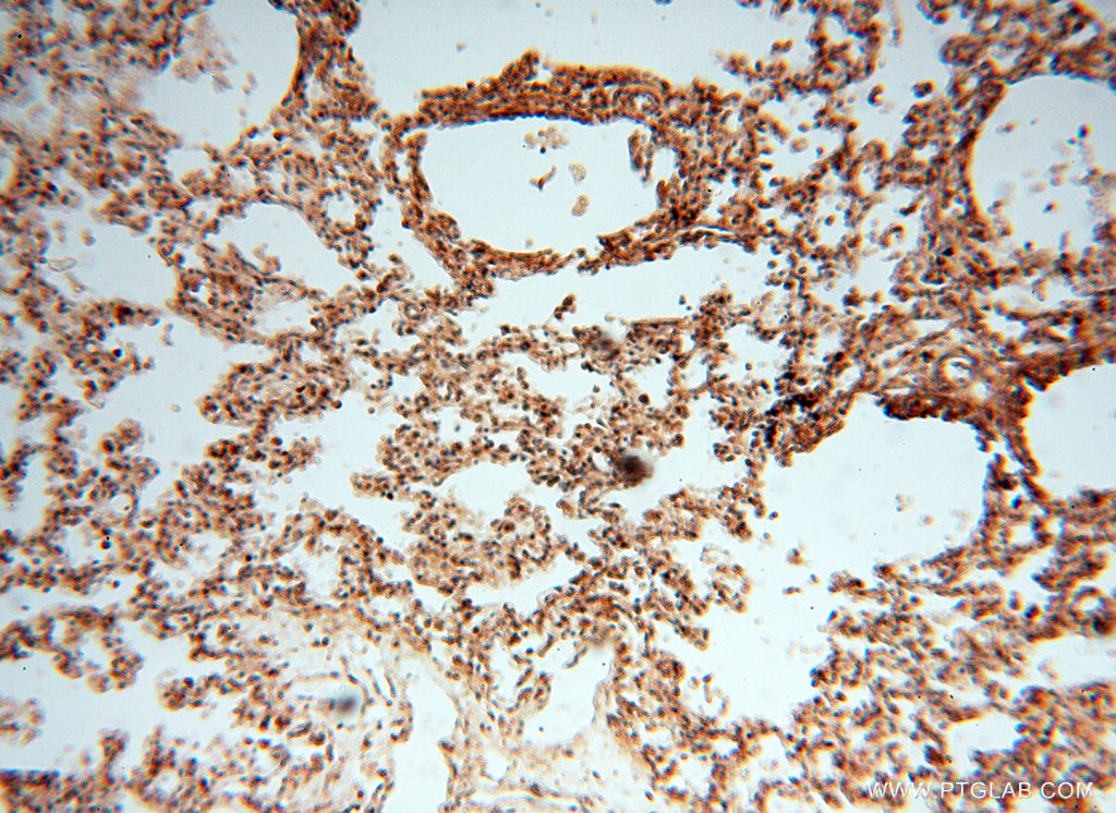 Immunohistochemistry (IHC) staining of human lung tissue using CSK Polyclonal antibody (17720-1-AP)