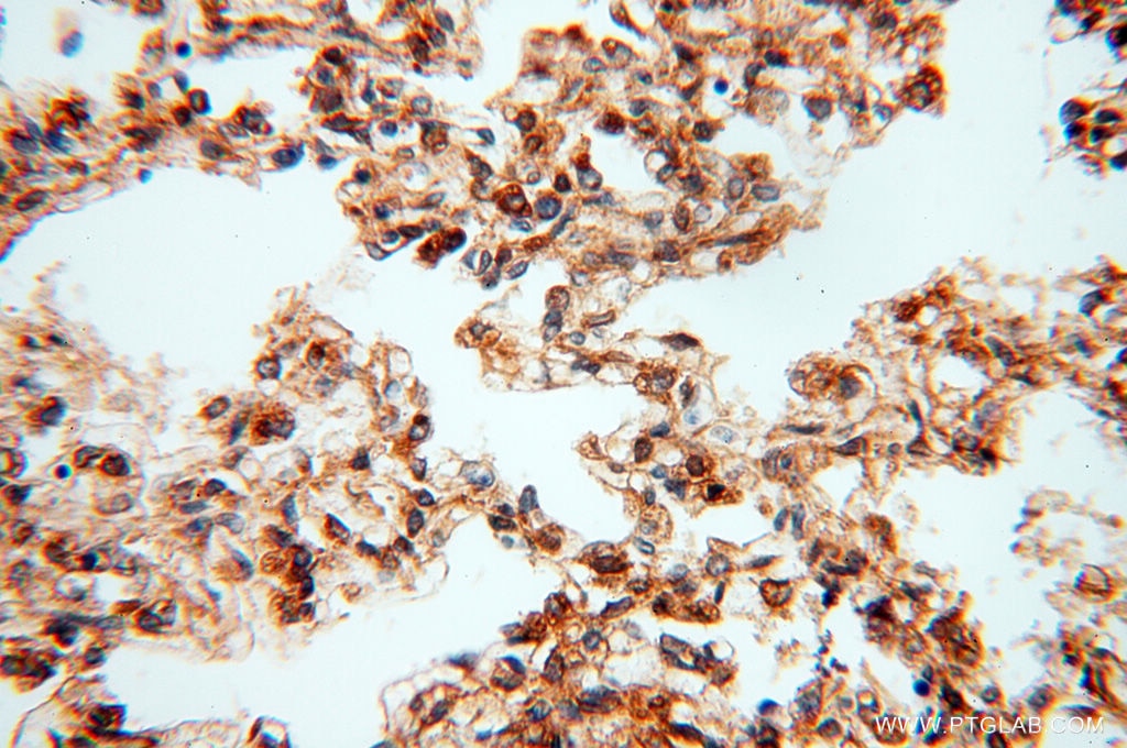 Immunohistochemistry (IHC) staining of human lung tissue using CSK Polyclonal antibody (17720-1-AP)