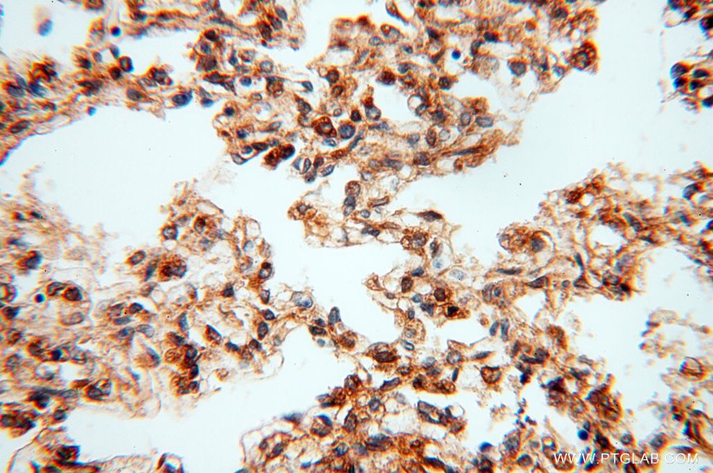 Immunohistochemistry (IHC) staining of human lung tissue using CSK Polyclonal antibody (17720-1-AP)